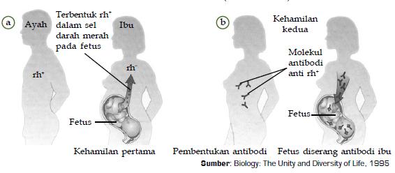 Kelainan atau Penyakit pada Sistem Peredaran Darah 