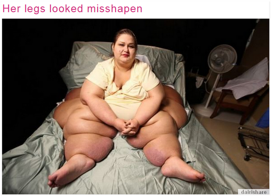 wanita%2Bgemuk3.PNG