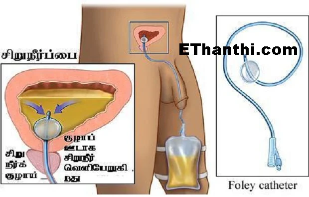 சிறுநீர் பிரச்சினைகள்