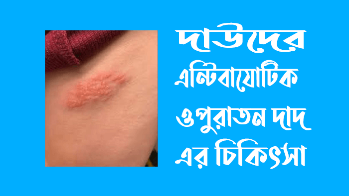 দাউদের এন্টিবায়োটিক