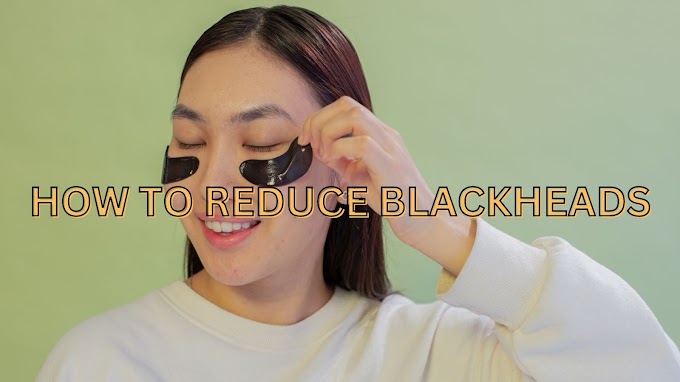 The best way to get rid of blackheads