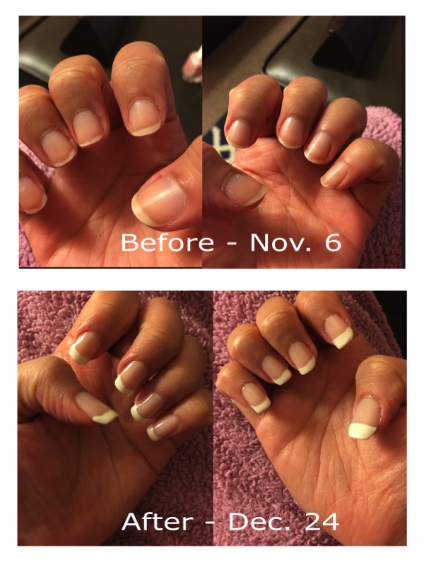 My Nail Growth Journey and the Best Tips and Tricks for Treating
