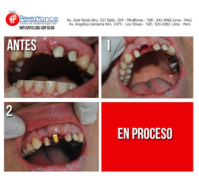  http://www.dentalperezyance.com/