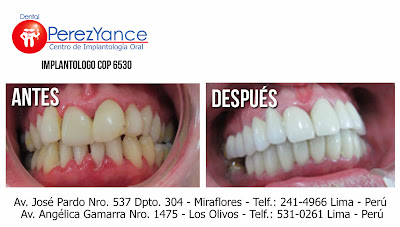  www.dentalperezyance.com