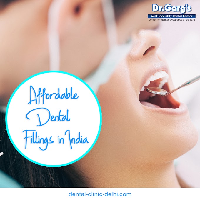 How to Find Affordable Dental Fillings in India?