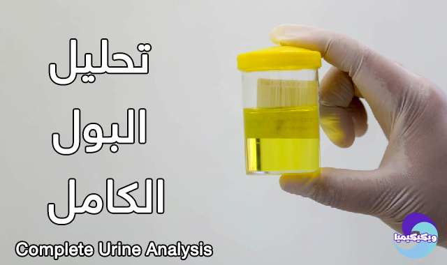 Complete Urine Analysis ( C.U.A )