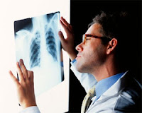 mesothelioma diagnosis