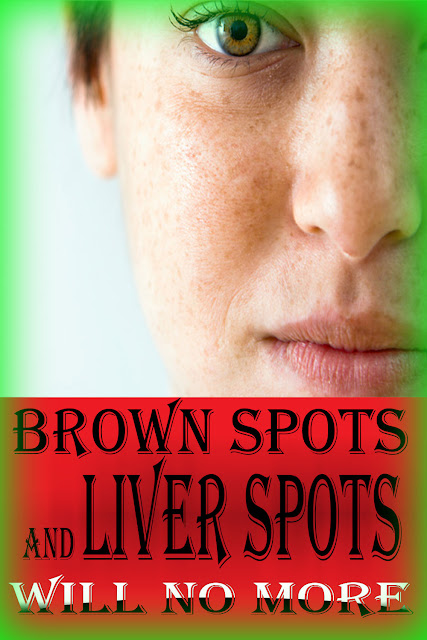 BROWN SPOTS AND LIVER SPOTS WILL NO MORE