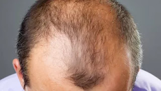 roghan zarareeh,hamdard roghan zarareeh,hamdard roghan zarareeh ke fayde,roghan zarareeh ke fayde,roghan zarareeh review,roghan zarareeh uses in hindi,roghan zarareeh price,roghan zarareeh in hindi,roghan zarareeh benefits,roghan zarareeh use in hindi,rogan zarareeh,roghan zarareeh oil benefits,hamdard,roghan e zarareeh,roghan zarareeh oil,hamdard roghan zarareeh oil,hamdard roghan zarareeh uses,roghan zarareeh results,hamdard roghan zarareeh review roghan zarareeh,hamdard roghan zarareeh,hamdard roghan zarareeh ke fayde,roghan zarareeh ke fayde,roghan zarareeh review,roghan zarareeh uses in hindi,roghan zarareeh price,roghan zarareeh in hindi,roghan zarareeh benefits,roghan zarareeh use in hindi,rogan zarareeh,roghan zarareeh oil benefits,hamdard,roghan e zarareeh,roghan zarareeh oil,hamdard roghan zarareeh oil,hamdard roghan zarareeh uses,roghan zarareeh results,hamdard roghan zarareeh review