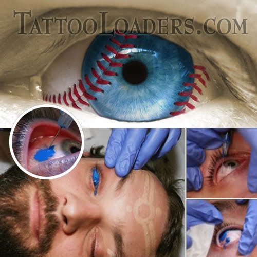 I'm sure eyeball tattoos hurt like hell but people are still getting them I'm sure eyeball tattoos hurt like hell but people are still getting them