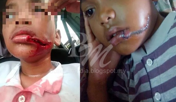 Ini kisah sebenar berlaku pada anak saya .. yang VIRAL itu tidak benar -Ibu (3Gambar)