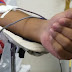 Hemorio lança hoje campanha Unidos pelo Sangue