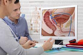 Effects of an enlarged prostate on the bladder