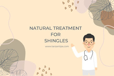 Natural Treatment for Shingles