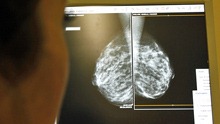 mammogram
