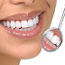 Profesionalno izbjeljivanje zuba po odličnoj cijeni u stomatološkoj ordinaciji Floss&Gloss!