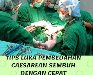 TIPS LUKA PEMBEDAHAN CAESAREAN SEMBUH DENGAN CEPAT 