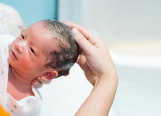 Cara Merawat Bayi Perempuan Baru Lahir
