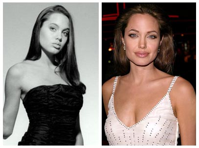 lady gaga before surgery. Angelina Jolie Plastic Surgery