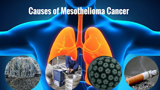 How Asbestos Causes Mesothelioma ( All About Mesothelioma )