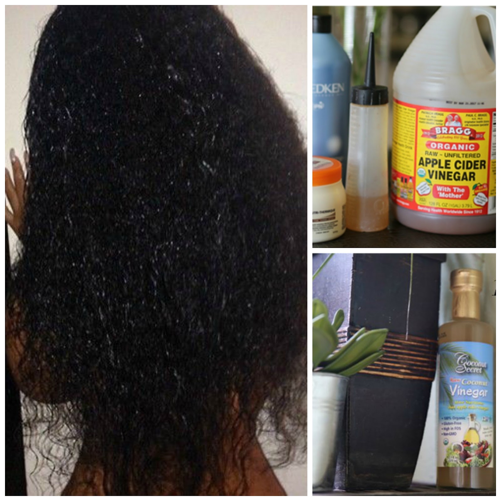 Shampoo Vinegar The Perfect Combination For Healthier Hair