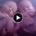Amazing! Twin Babies Caught On MRI Scan Fighting In Their Mother’s Womb