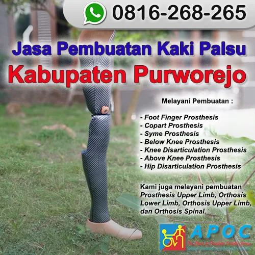 Jasa Pembuatan Kaki Palsu Kabupaten Purworejo >> WA 0816-268-265, Kaki Palsu Namanya