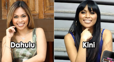 dayang nurfaizah tak buat botox, Dayang Nurfaizah, wajah dayang semakin runcing dayang pakai braces, braces, pendakap gigi, splash_popular, artis malaysia, berita, gambar, berita terkini, hiburan, selebriti