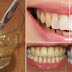 How To Whiten Teeth Within 3 Minutes With 2-Ingredients!
