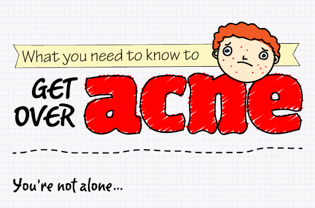 Get Over Acne - Tips