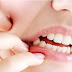 Cara Mengobati Sakit Gigi Berlubang Secara Alami