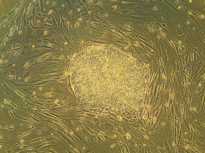 Embryonic stem cell - Bλαστοκύτταρα – Χρήσεις και Βιοηθικοί Προβληματισμοί - Stem Cells - Uses and Bioethical Issues- Βοπηική - Χροστιανική ηθική 