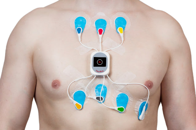 Holter Monitoring Systems