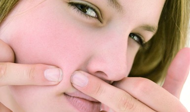 como quitar el acne rapido3
