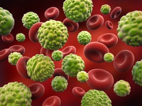 How To Out-Smart Cancer & What The Medical Industry Isn’t Telling You