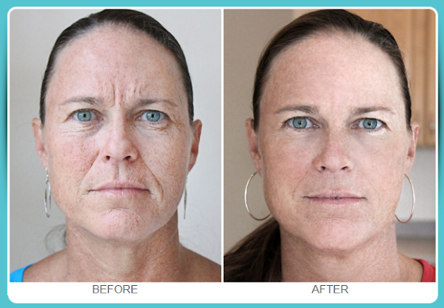 Flawless Complexion - Look Years Younger Effects!