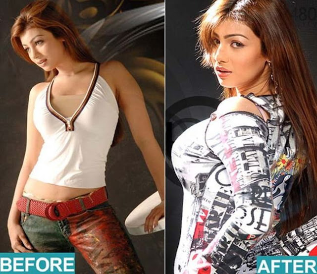 Not so Natural! 7 Bollywood Beauties Who Went for Implants