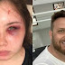  Saiba quem é o sertanejo acusado de agredir e tentar matar a filha