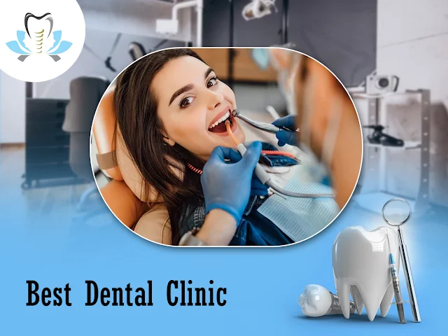 dental care centre in JP Nagar