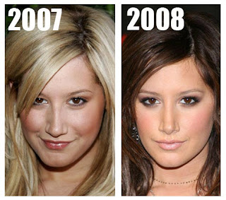 Ashley Tisdale Plastic Surgery Before And After