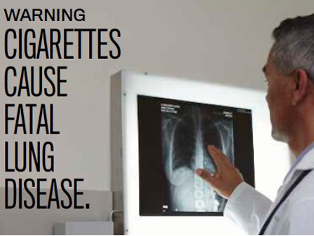 Fatal lung