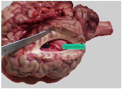Ammon horn, dalam incisi permukaan dorsal otak