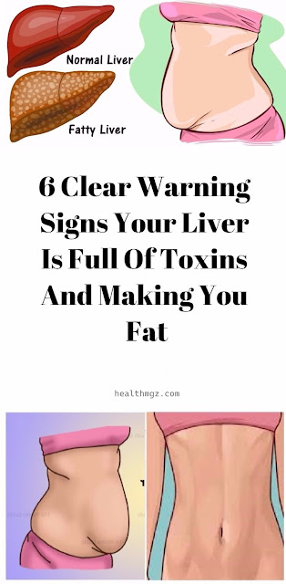 6 Clear Warning Signs Your Liver Is Full Of Toxins And Making You Fat