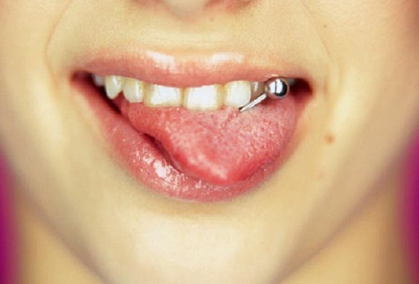 Thói quen không tốt đeo khuyên lên lưỡi tổn thương răng