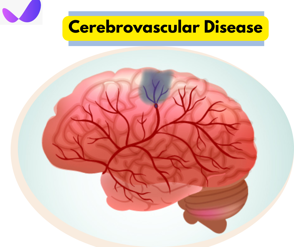 Cerebrovascular Disease