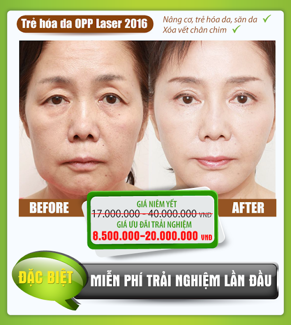 Trẻ hóa da OPP Laser 2016