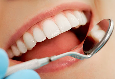 Quy trình bọc răng sứ Zirconia như thế nào?