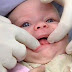 Bebeklerde diş çıkartma ve ilk diş