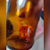 Homem diz ter encontrado um dedo dentro de cerveja: “Tinha até unha”