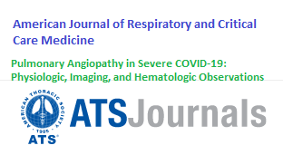 Angiopatia pulmonar em COVID-19 grave